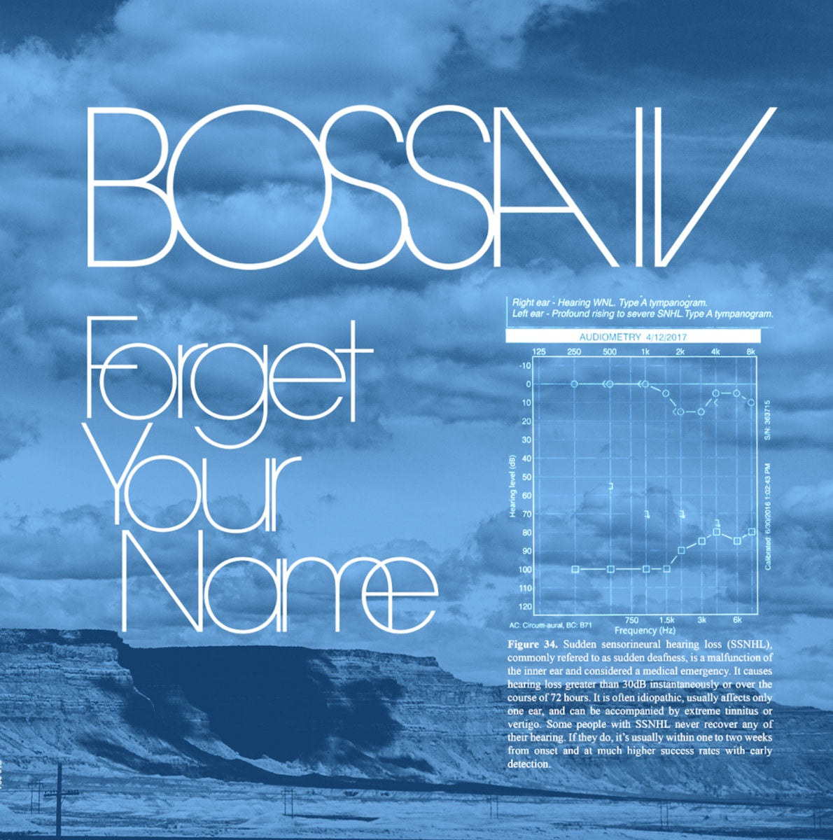 Bossa IV - Forget Your Name - New Vinyl LP Record 2019 - Chicago Indie Rock