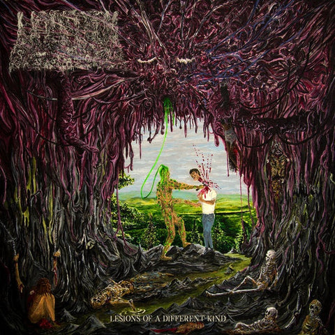 Undeath ‎– Lesions Of A Different Kind - New LP Record 2020 Prosthetic Vinyl - Death Metal